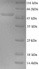 Greater than 90% as determined by SDS-PAGE.Recombinant Human Papillomavirus Type 18 Minor Capsid Protein L2 (L2) Protein (His)
