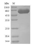 Greater than 90% as determined by SDS-PAGE.Recombinant Saccharomyces Cerevisiae Serine--Trna Ligase, Cytoplasmic Domain (SES1) Protein (His)