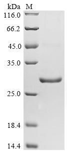 Greater than 90% as determined by SDS-PAGE.Recombinant Schistosoma Japonicum Glutathione S-Transferase Class-Mu 26 Kda Isozyme (GST26) Protein (His)