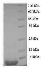 Greater than 90% as determined by SDS-PAGE.Recombinant Enterobacteria Phage 933W Shiga-Like Toxin 2 Subunit B (STXB2) Protein (His)