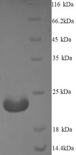 Greater than 90% as determined by SDS-PAGE.Recombinant Mycobacterium Tuberculosis Immunogenic Protein Mpt64 (MPT64) Protein (His)