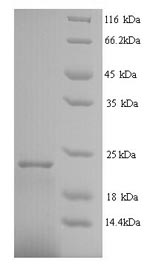 Greater than 90% as determined by SDS-PAGE.Recombinant Human Interferon Alpha-2 (IFNA2) Protein (His)