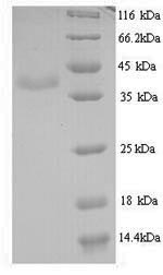 Greater than 90% as determined by SDS-PAGE.Recombinant Bk Polyomavirus Minor Capsid Protein Vp2 Protein (His)