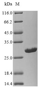 Greater than 90% as determined by SDS-PAGE.Recombinant Bunyavirus La Crosse Nucleoprotein (N) Protein (His)
