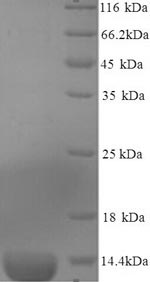 Greater than 90% as determined by SDS-PAGE.Recombinant Mouse Serum Amyloid A-3 Protein (SAA3) Protein (His)