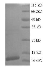 Greater than 90% as determined by SDS-PAGE.Recombinant Human Papillomavirus Type 18 Protein E7 (E7) Protein (His)