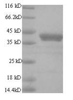 Greater than 90% as determined by SDS-PAGE.
