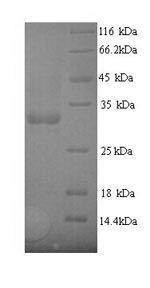 Greater than 90% as determined by SDS-PAGE.Recombinant E.Coli Type 1 Fimbrin D-Mannose Specific Adhesin (FIMH) Protein (His)