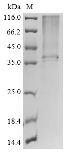 Greater than 85% as determined by SDS-PAGE.Recombinant E.Coli Type 1 Fimbrin D-Mannose Specific Adhesin (FIMH) Protein (SKIK&His)