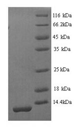 Greater than 90% as determined by SDS-PAGE.Recombinant Mouse Serine Protease Inhibitor Kazal-Type 1 (SPINK1) Protein (His)