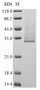 Greater than 90% as determined by SDS-PAGE.Recombinant Borreliella Burgdorferi Outer Surface Protein A (OSPA) Protein (His)