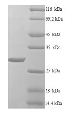 Greater than 90% as determined by SDS-PAGE.Recombinant Klebsiella Pneumoniae Beta-Lactamase Shv-1 (BLA) Protein (His)