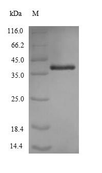 Greater than 90% as determined by SDS-PAGE.Recombinant Acinetobacter Baumannii Outer Membrane Protein Omp38 (OMP38) Protein (His)