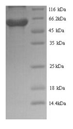 Greater than 90% as determined by SDS-PAGE.Recombinant Rabies Virus Glycoprotein (G) Protein (His)