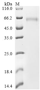Greater than 85% as determined by SDS-PAGE.Recombinant Horse Plasminogen Activator Inhibitor-1 (PAI-1)