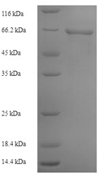 Greater than 90% as determined by SDS-PAGE.Recombinant Bacteroides Vulgatus Alpha-1,3-Galactosidase B (GLAB1) Protein (His)