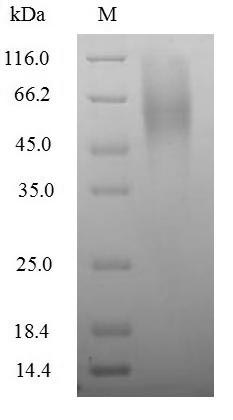 Greater than 90% as determined by SDS-PAGE.Recombinant Rotavirus A Outer Capsid Glycoprotein Vp7 Protein (His)