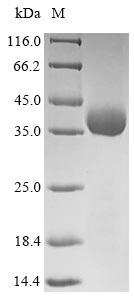 Greater than 85% as determined by SDS-PAGE.Recombinant Rotavirus X Outer Capsid Protein Vp4 Protein (His)