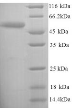 Greater than 90% as determined by SDS-PAGE.Recombinant Salmonella Heidelberg D-Serine Dehydratase (DSDA) Protein (His)