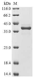 Greater than 90% as determined by SDS-PAGE.