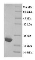 Greater than 90% as determined by SDS-PAGE.Recombinant Human Immunoglobulin Lambda-Like Polypeptide 5 (IGLL5) Protein (His)