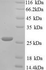 Greater than 90% as determined by SDS-PAGE.Recombinant Klebsiella Pneumoniae Metallo-Beta-Lactamase Type 2 (BLANDM-1) Protein (His)