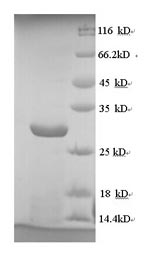 Greater than 90% as determined by SDS-PAGE.Recombinant Human Cytomegalovirus Envelope Glycoprotein L (GL) Protein (His)