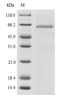 Greater than 90% as determined by SDS-PAGE.Recombinant Human Podocalyxin (PODXL) Protein (His)