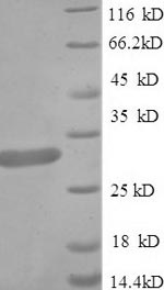 Greater than 90% as determined by SDS-PAGE.Recombinant Crotalus Adamanteus Thrombin-Like Enzyme Crotalase (SVTLE) Protein (His)