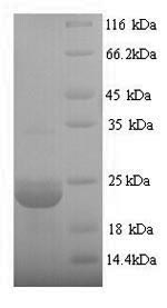 Greater than 90% as determined by SDS-PAGE.Recombinant Bacillus Subtilis Expansin-Yoaj (YOAJ) Protein (His)