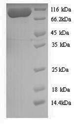 Greater than 90% as determined by SDS-PAGE.Recombinant Aquifex Aeolicus Dna Mismatch Repair Protein Muts (MUTS) Protein (His)
