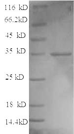 Greater than 90% as determined by SDS-PAGE.Recombinant Bacillus Thuringiensis Subsp. Pesticidal Crystal Protein Cry1Fb (CRY1FB) Protein (His)