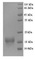 Greater than 90% as determined by SDS-PAGE.Recombinant Mouse Bis (FHIT) Protein (His)