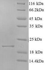 Greater than 90% as determined by SDS-PAGE.