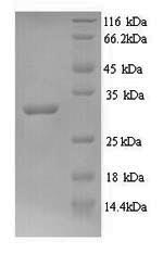 Greater than 90% as determined by SDS-PAGE.Recombinant Mycobacterium Tuberculosis Signal Peptidase I (LEPB) Protein (His)