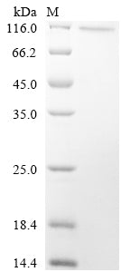 Greater than 90% as determined by SDS-PAGE.Recombinant Human Histone-Lysine N-Methyltransferase Ezh2 (EZH2) Protein (His)