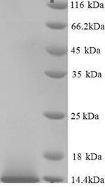 Greater than 90% as determined by SDS-PAGE.Recombinant Human Guanylate Cyclase Activator 2B (GUCA2B) Protein (His)
