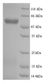 Greater than 90% as determined by SDS-PAGE.Recombinant Human Hyaluronidase-2 (HYAL2) Protein (His)