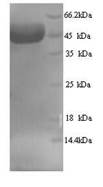 Greater than 90% as determined by SDS-PAGE.Recombinant Human Myosin-Binding Protein C, Fast-Type (MYBPC2) Protein (His)
