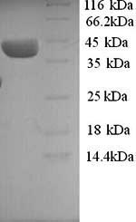 Greater than 90% as determined by SDS-PAGE.Recombinant Human Elav-Like Protein 3 (ELAVL3) Protein (His)