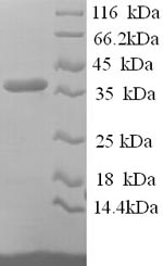 Greater than 90% as determined by SDS-PAGE.Recombinant Human Reticulocalbin-1 (RCN1) Protein (His)
