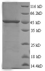 Greater than 90% as determined by SDS-PAGE.Recombinant Human Swi/Snf-Related Matrix-Associated Actin-Dependent Regulator Of Chromatin Subfamily B Member 1 (SMARCB1) Protein (His)