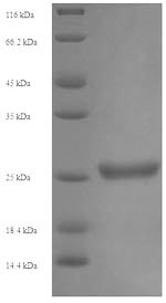 Greater than 90% as determined by SDS-PAGE.Recombinant Human Killer Cell Immunoglobulin-Like Receptor 2Ds1 (KIR2DS1) Protein (His)