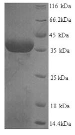 Greater than 90% as determined by SDS-PAGE.Recombinant Human Squamous Cell Carcinoma Antigen Recognized By T-Cells 3 (SART3) Protein (His)
