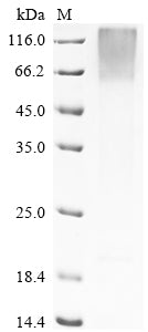 Greater than 85% as determined by SDS-PAGE.Recombinant Bovine Pregnancy-Associated Glycoprotein 1 (PAG1) Protein (His-sumostar)
