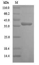 Greater than 90% as determined by SDS-PAGE.Recombinant Arabidopsis Thaliana Cyclin-Dependent Kinase B1-2 (CDKB1-2) Protein (His)