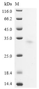 Greater than 90% as determined by SDS-PAGE.Recombinant Mouse Usherin (USH2A) Protein (His)