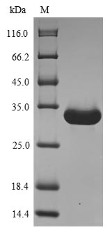 Greater than 90% as determined by SDS-PAGE.Recombinant Mouse Angiogenin-4 (ANG4) Protein (His-sumostar)