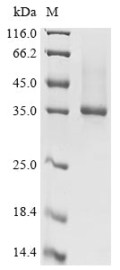 Greater than 90% as determined by SDS-PAGE.Recombinant Mouse Olfactomedin-4 (OLFM4) Protein (His-Myc)