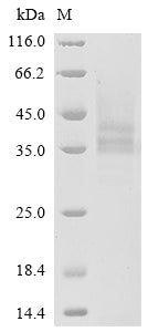 Greater than 85% as determined by SDS-PAGE.Recombinant Human Poly [Adp-Ribose] Polymerase 14 (PARP14) Protein (His)
